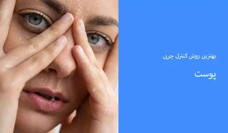 بهترین روش کنترل چربی پوست