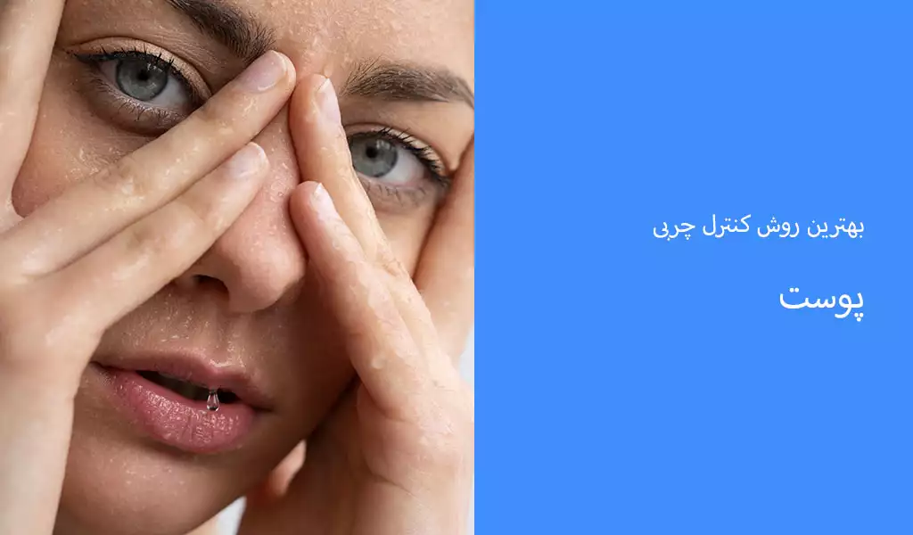بهترین روش کنترل چربی پوست